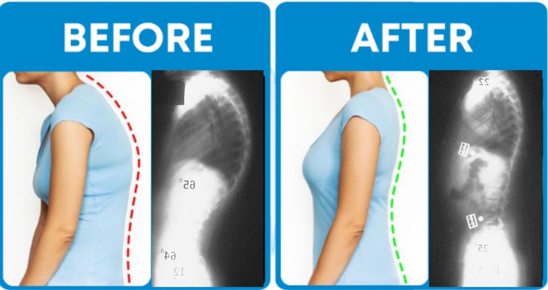 Portable Seat Cushion - Image 3