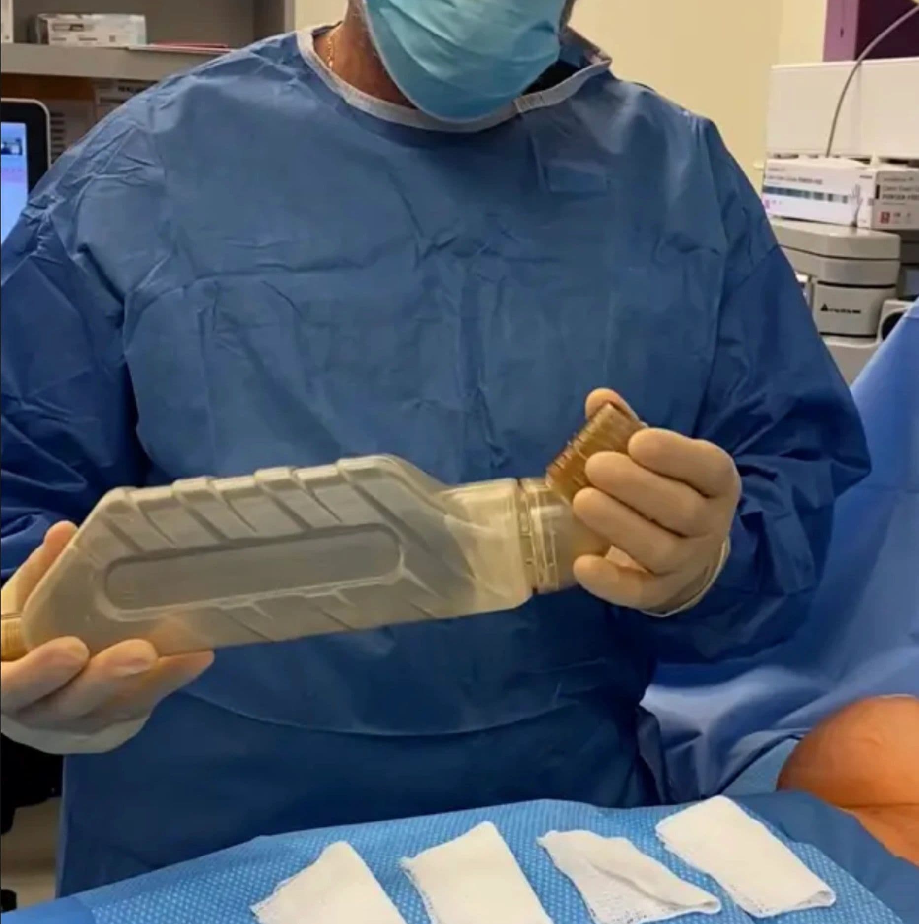 No-Touch Surgical Evacuation System  Transforming Breast Implant Removal, Trauma Surgery & Hematoma Evacuation - Image 2